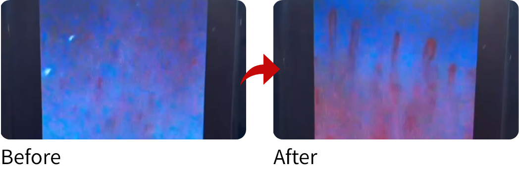 40代女性　毛細血管：酸素BOX利用