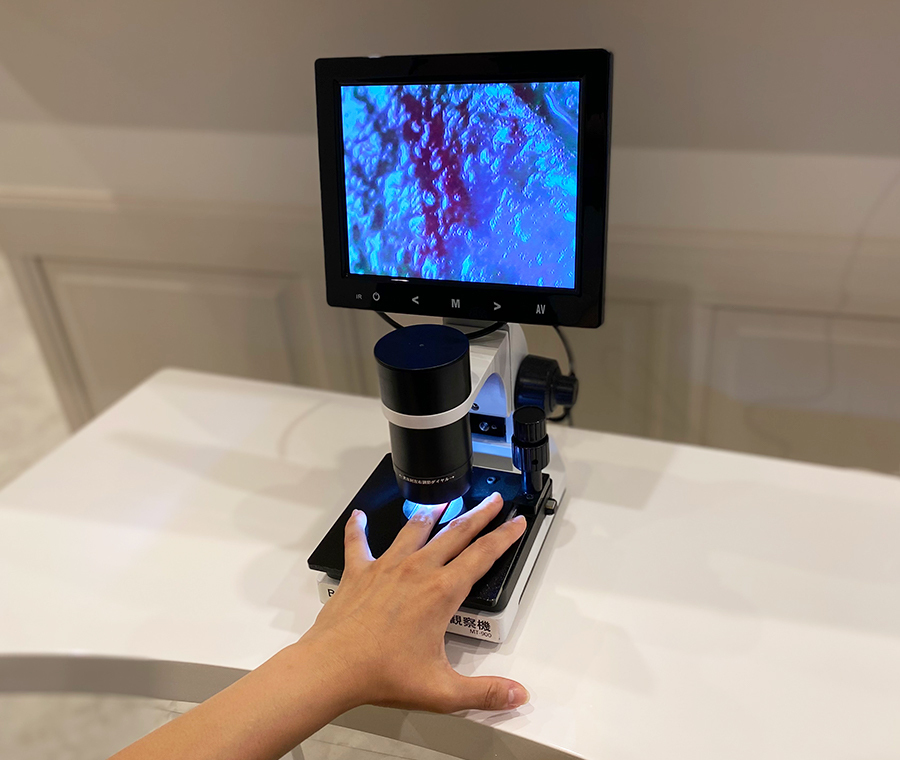 血流スコープで酸素の可視化