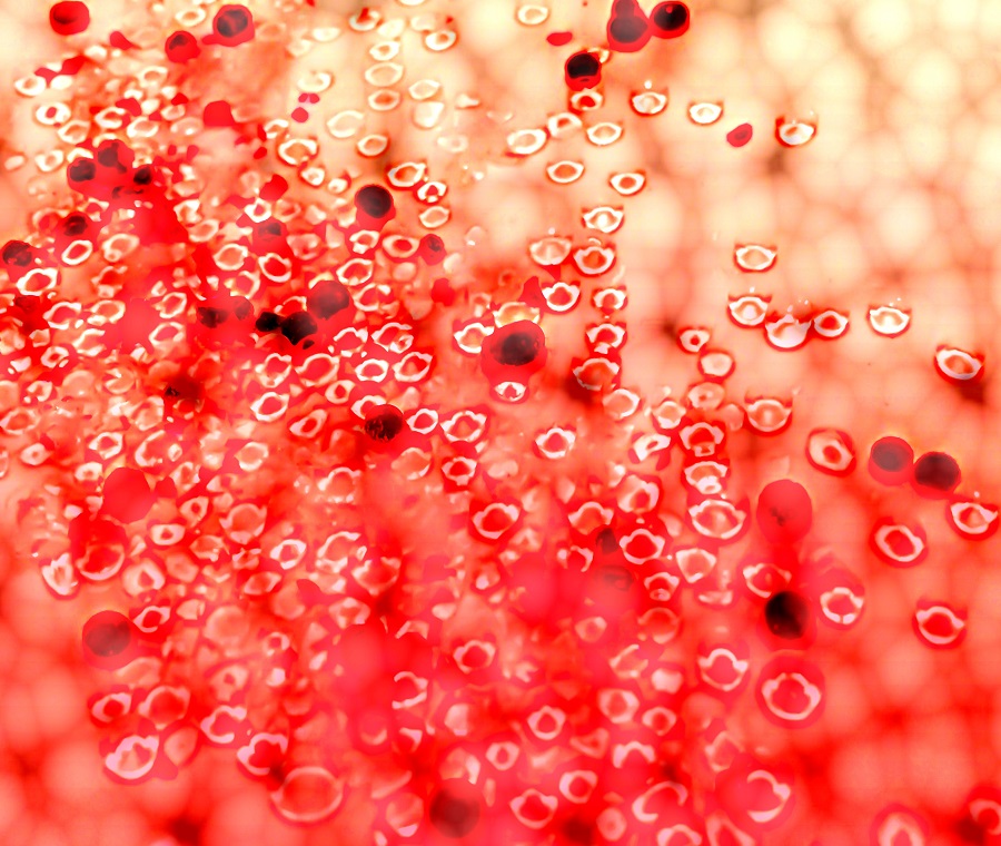 結合型酸素と溶解型酸素について